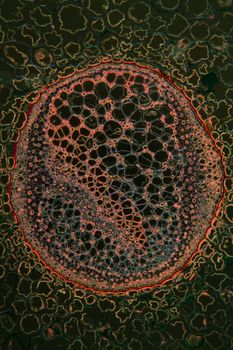 Bracken stems in cross section 100x