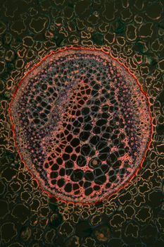 Bracken stems in cross section 100x