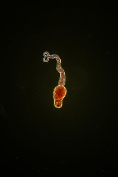 Billharzia pathogen larva Furcozerkarien 200x