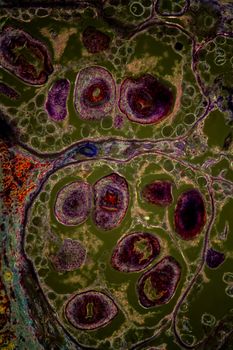 Echinococcus parasitic liver fluke magnified 100x
