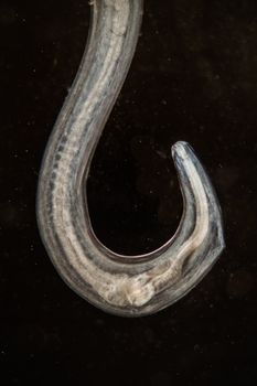 parasitic worm under the microscope 100x