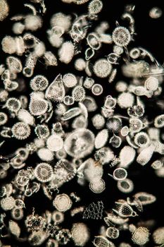 Radiolaria marine animals under the microscope 100x