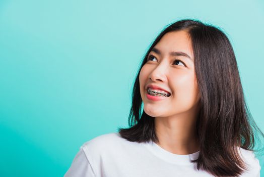 Closeup teen Asian beautiful young woman smile have dental braces on teeth laughing she looking side away space, studio shot isolated on a blue background, medicine and dentistry female mouth concept
