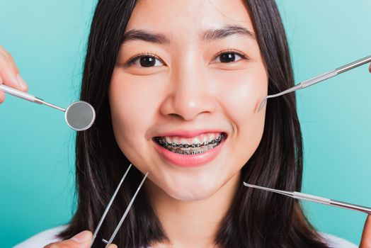 Asian teen beautiful young woman smile have dental braces on teeth laughing and have medical equipment tools for check tooth, isolated on a blue background, Medicine and dentistry concept