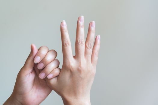 Woman massaging her painful hand. Healthcare and medical concept.