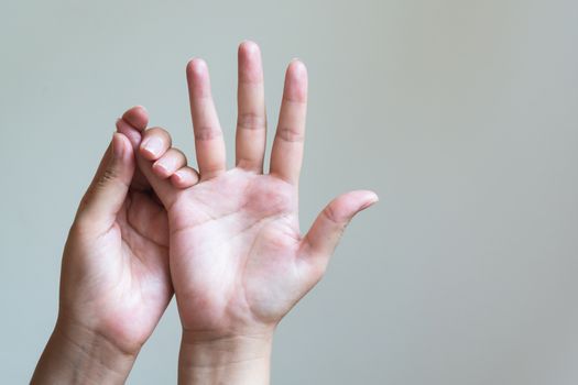 Woman massaging her painful hand. Healthcare and medical concept.