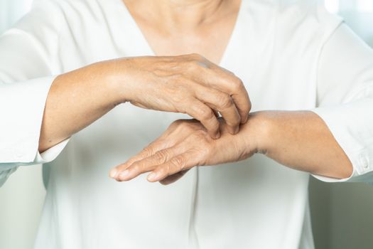 senior women scratch the itch on eczema hand, healthcare and medicine concept