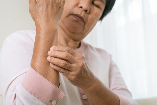 senior women scratch arm the itch on eczema arm, healthcare and medicine concept