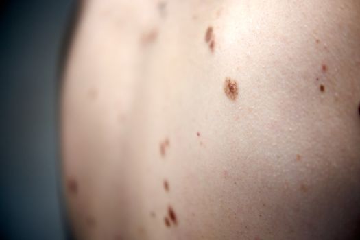 Middle-aged hispanic man examines the size, color and shape of a mole he has in his cheek. Prevention of melanoma, skin cancer.