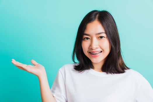 Portrait of Asian teen beautiful young woman smile have dental braces on teeth laughing she show hand side blank space, isolated on a blue background, Medicine and dentistry concept