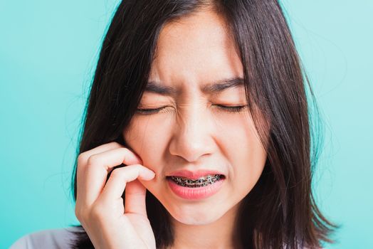 Portrait of Asian teen beautiful young woman smile have dental braces on teeth laughing she unhappy pain toothache and touch cheek by hand, isolated on blue background, Medicine and dentistry concept