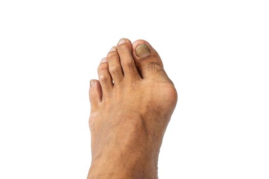 Closeup men's feet isolated on white background.