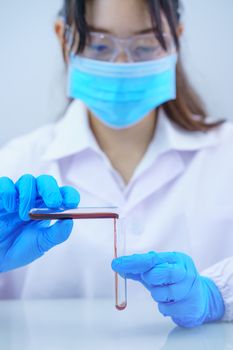 Technician scientist analyzing a blood sample in test tube in laboratory for testing it on COVID, COVID-19, coronavirus virus analysis