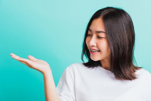 Portrait of Asian teen beautiful young woman smile have dental braces on teeth laughing she show hand side blank space, isolated on a blue background, Medicine and dentistry concept