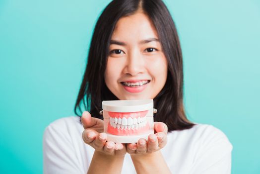 Portrait of Asian teen beautiful young woman smile have dental braces on teeth laughing she holding medical equipment dental model teeth, isolated on a blue background, Medicine and dentistry concept