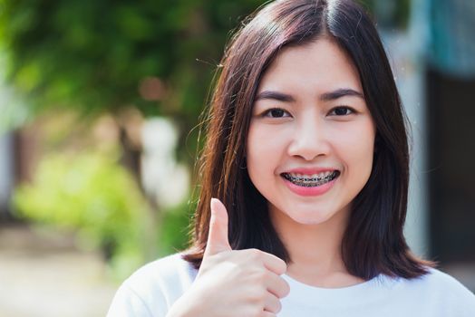 Portrait of Asian teen beautiful young woman smile have dental braces on teeth laughing outdoor, Medicine and dentistry concept