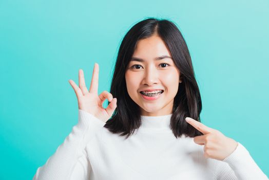 Asian teen beautiful young woman smile have dental braces on teeth laughing she showing gesturing ok sign with fingers, isolated on a blue background, Medicine and dentistry concept