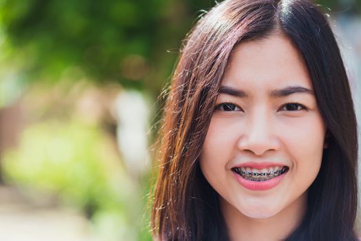 Portrait of Asian teen beautiful young woman smile have dental braces on teeth laughing outdoor, Medicine and dentistry concept