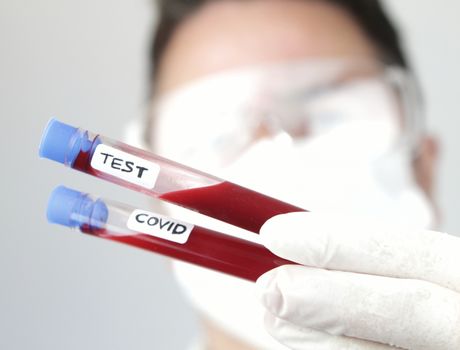 Laboratory assistant wearing protective glasses and surgery gloves holding test tube of Covid-19 virus