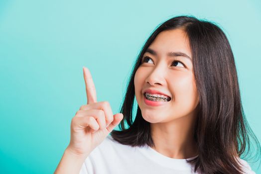 Portrait of Asian teen beautiful young woman smile have dental braces on teeth laughing point finger side away blank copy space, studio shot isolated on blue background, medicine and dentistry concept