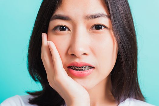 Portrait of Asian teen beautiful young woman smile have dental braces on teeth laughing she unhappy pain toothache and touch cheek by hand, isolated on blue background, Medicine and dentistry concept