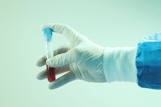 Blood test full tubes in doctor's hand, on the white background, studio shoot.