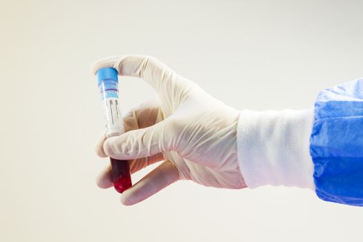 Blood test full tubes in doctor's hand, on the white background, studio shoot.