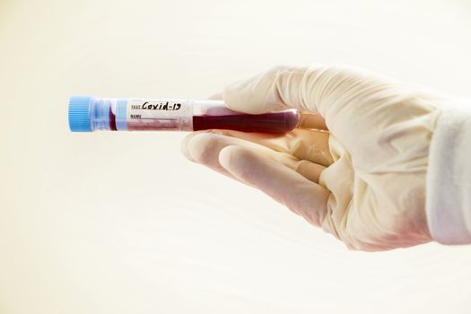 Corona virus blood test tubes on the white background, studio shoot. Blood test samples. Diagnosis and laboratory.