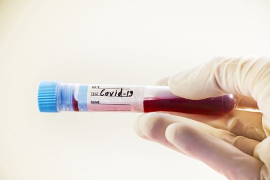 Corona virus blood test tubes on the white background, studio shoot. Blood test samples. Diagnosis and laboratory.