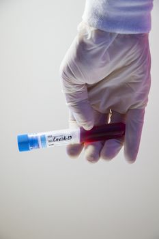 Covid - 19 and corona virus blood test sample, negative and positive tests, reagents and glassware.