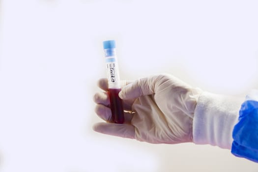 Corona virus blood test tubes on the white background, studio shoot. Blood test samples. Diagnosis and laboratory.