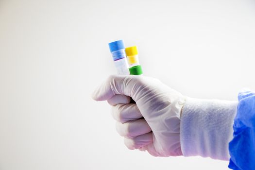 Blood test full tubes in hand, holding tubes,on the white background, studio shoot.