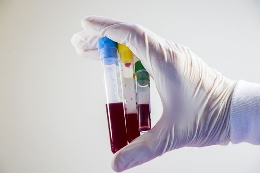 Blood test full tubes in hand, holding tubes,on the white background, studio shoot.