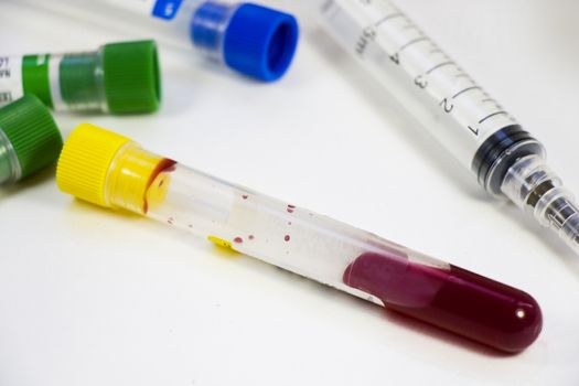 Blood test full tubes samples on the white background, studio shoot.