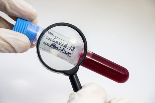 Corona virus positive blood test tubes on the white background, studio shoot. Blood test samples. Diagnosis and laboratory.