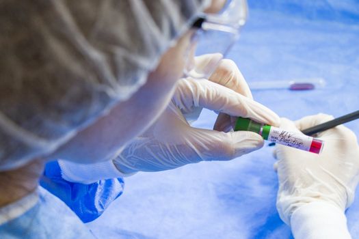 Hiv and aids infection test, doctors face and hand holding tube with blood on the blue background. Studio shoot.