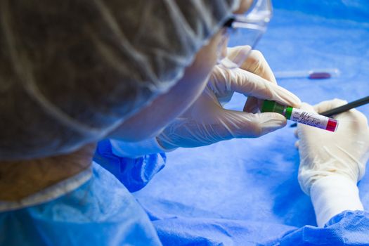 Hiv and aids infection test, doctors face and hand holding tube with blood on the blue background. Studio shoot.