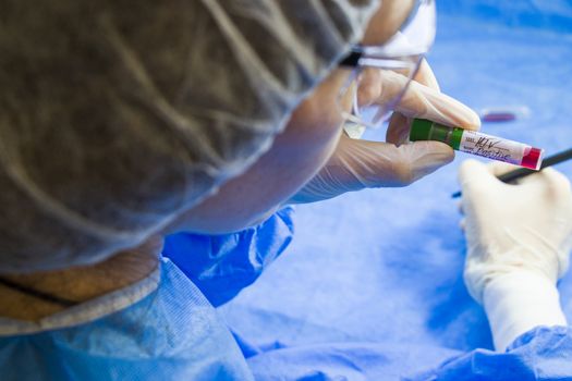 Hiv and aids infection test, doctors face and hand holding tube with blood on the blue background. Studio shoot.