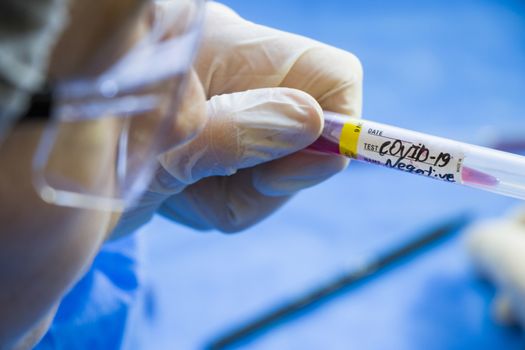 Corona virus negative blood test tubes on the white background, studio shoot. Blood test samples. Diagnosis and laboratory.