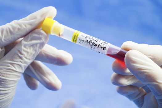 Corona virus negative blood test tubes on the white background, studio shoot. Blood test samples. Diagnosis and laboratory.