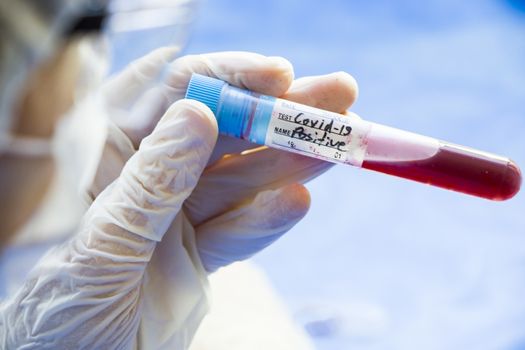 Corona virus positive blood test tubes on the white background, studio shoot. Blood test samples. Diagnosis and laboratory.