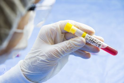 Corona virus negative blood test tubes on the white background, studio shoot. Blood test samples. Diagnosis and laboratory.