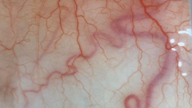 for medical knowledge Human eyes close up image with veins.