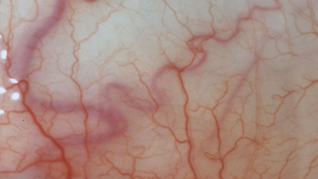 for medical knowledge Human eyes close up image with veins.