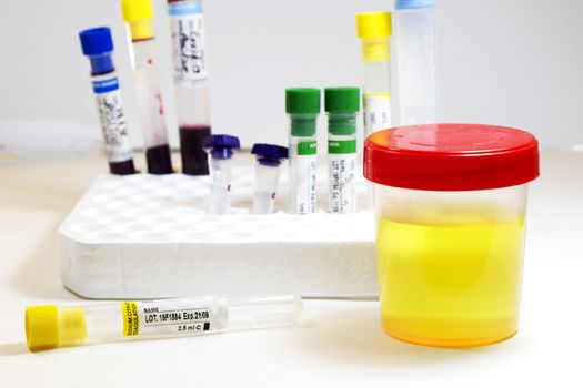 Drug test, medical urine and pee test with blood and other tubes on the white background, colorful lab test containers, viruses and doping laboratory tests. Covid 19, HIV, aids and other infections