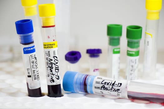 Corona virus and Covid-19 positive blood test tubes on the white background, studio shoot. Blood test samples. Diagnosis and laboratory.