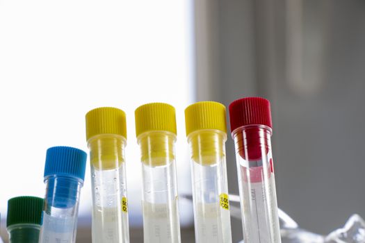 Laboratory blood test tube samples, research diagnoses, instruments and objects in the sterile table Studio shoot.