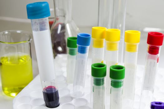 Laboratory blood test tube samples, research diagnoses, instruments and objects in the sterile table Studio shoot.