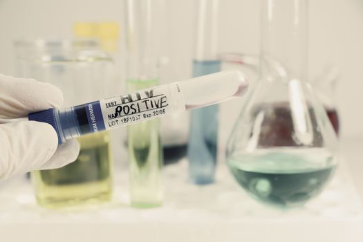 HIV blood test tube sample, aids immune viruses.