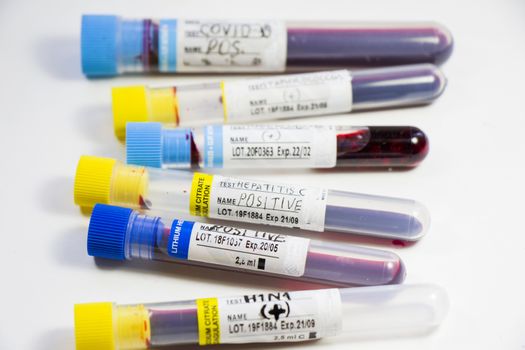 H1N1, Covid-19, Hepatitis C, Tuberculosis and Staphylococcus viruses blood tests in the tubes, laboratory diagnostics, texts and letter.